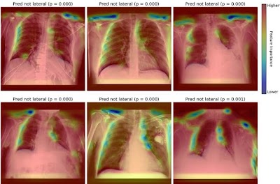Radiology: Artificial Intelligence (@radiology_ai) on Twitter photo AutoQC: Generalizable #AI pipeline can automatically curate, standardize, & provide a statistical overview of large CXR datasets doi.org/10.1148/ryai.2… <a href="/JWeirMcCall/">Jonathan Weir-McCall</a> <a href="/radiology_UOC/">Department of Radiology, University of Cambridge</a> <a href="/FacultyMaths/">Faculty of Mathematics - University of Cambridge</a> #ChestRad #QualityControl #DeepLearning AutoQC: Generalizable #AI pipeline can automatically curate, standardize, & provide a statistical overview of large CXR datasets doi.org/10.1148/ryai.2… <a href="/JWeirMcCall/">Jonathan Weir-McCall</a> <a href="/radiology_UOC/">Department of Radiology, University of Cambridge</a> <a href="/FacultyMaths/">Faculty of Mathematics - University of Cambridge</a> #ChestRad #QualityControl #DeepLearning