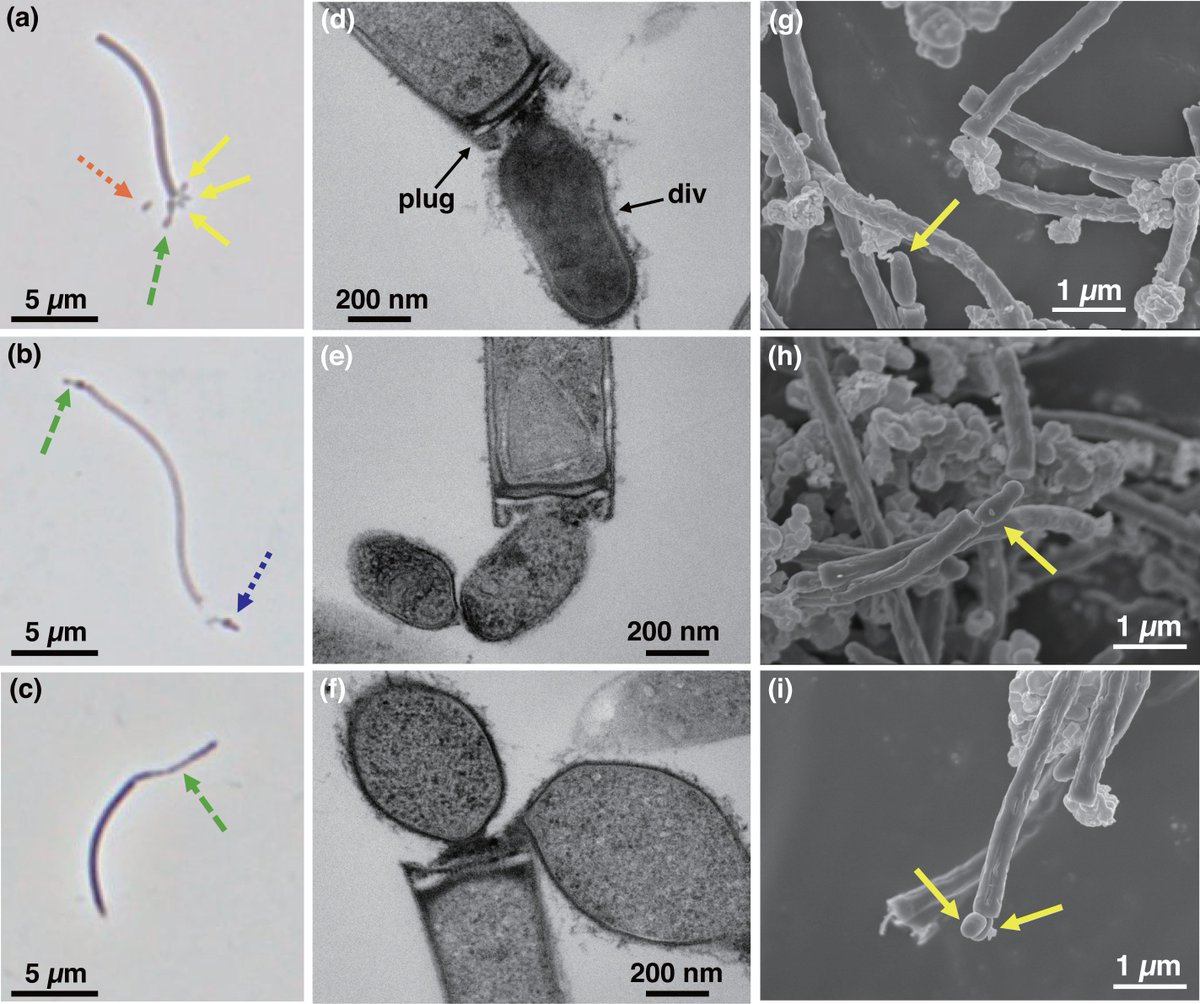 Evgenii Protasov (@protasov_evgeni) on Twitter photo Patescibacteria aka Candidate Phyla Radiation becomes the phylum Minisyncoccota with Minisyncoccus archaeiphilus as the type species. Anaerobic parasitic bacterium grow on #methanogen M. hungatei cells as a host.
<a href="/MicrobioSoc/">Microbiology Society</a>
#microbiology #taxonomy
microbiologyresearch.org/content/journa… Patescibacteria aka Candidate Phyla Radiation becomes the phylum Minisyncoccota with Minisyncoccus archaeiphilus as the type species. Anaerobic parasitic bacterium grow on #methanogen M. hungatei cells as a host.
<a href="/MicrobioSoc/">Microbiology Society</a>
#microbiology #taxonomy
microbiologyresearch.org/content/journa…