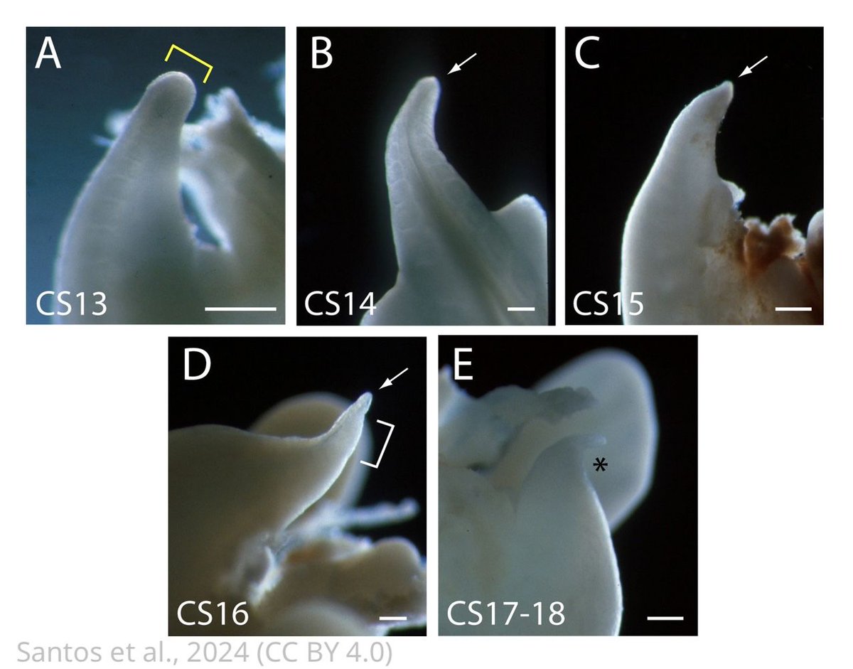 🌟 Special Issue highlight 🌟

‘Spinal neural tube formation and tail development in human embryos’

Read this 'Fundamental' study and more in our #ReproductiveHealth Special Issue!
elifesciences.org/articles/88584…