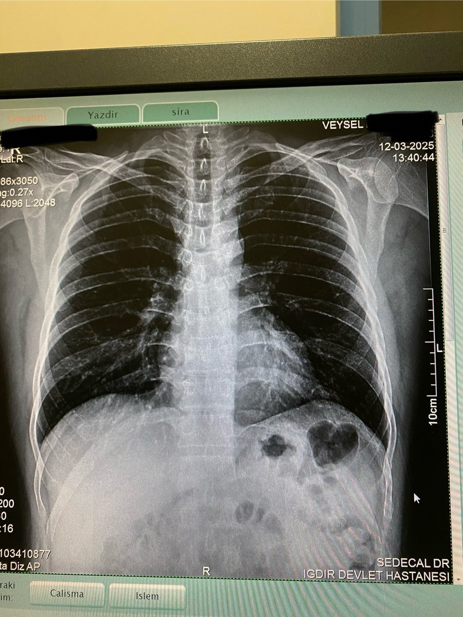 Erkeklerin  her gönül işlerine sıçmalarının nedeni buymuşş
