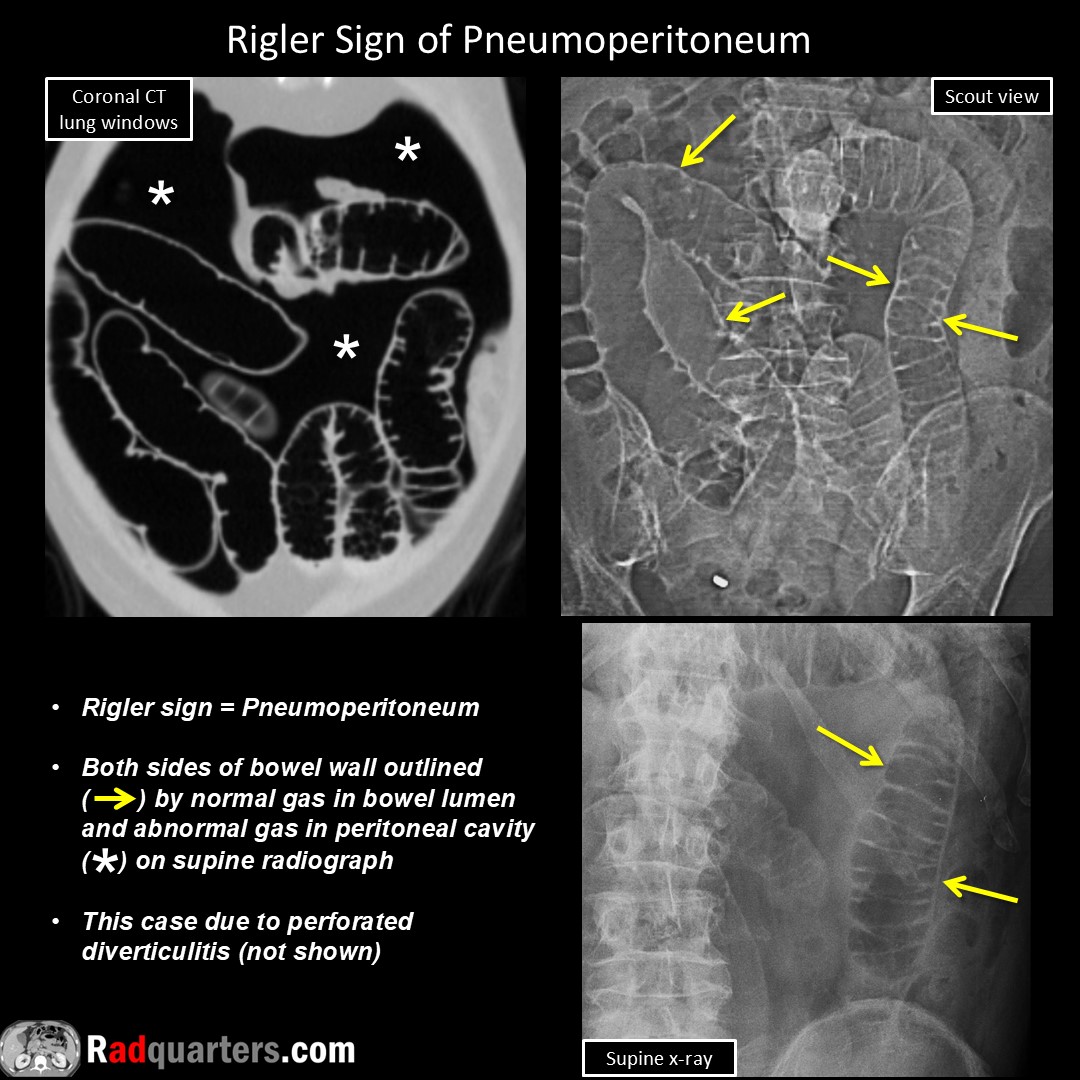 Radquarters's tweet image. #FOAMrad #FOAMed #radres #radtech #medstudent #radquarters