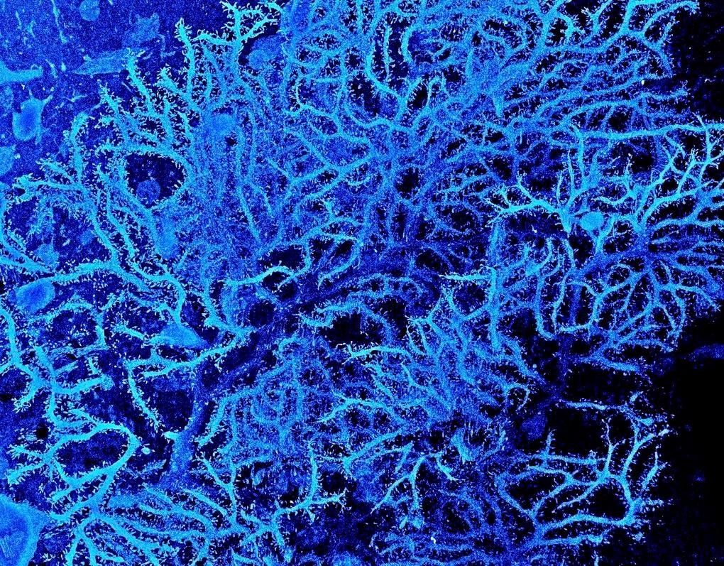 BigBangSciCom's tweet photo. Des cellules neuronales dites de Purkinje, vues au M.E.B

Crédits : M.Hausser, S.Rieubland et A.Roth

#beautifulscience #Anatomie #Anatomy #HumanBody #CorpsHumain #Biologie #Biology #SVT #Science #Imagerie #microbiology #microbiologie #microscopie https://t.co/FS8Y4cEPIH