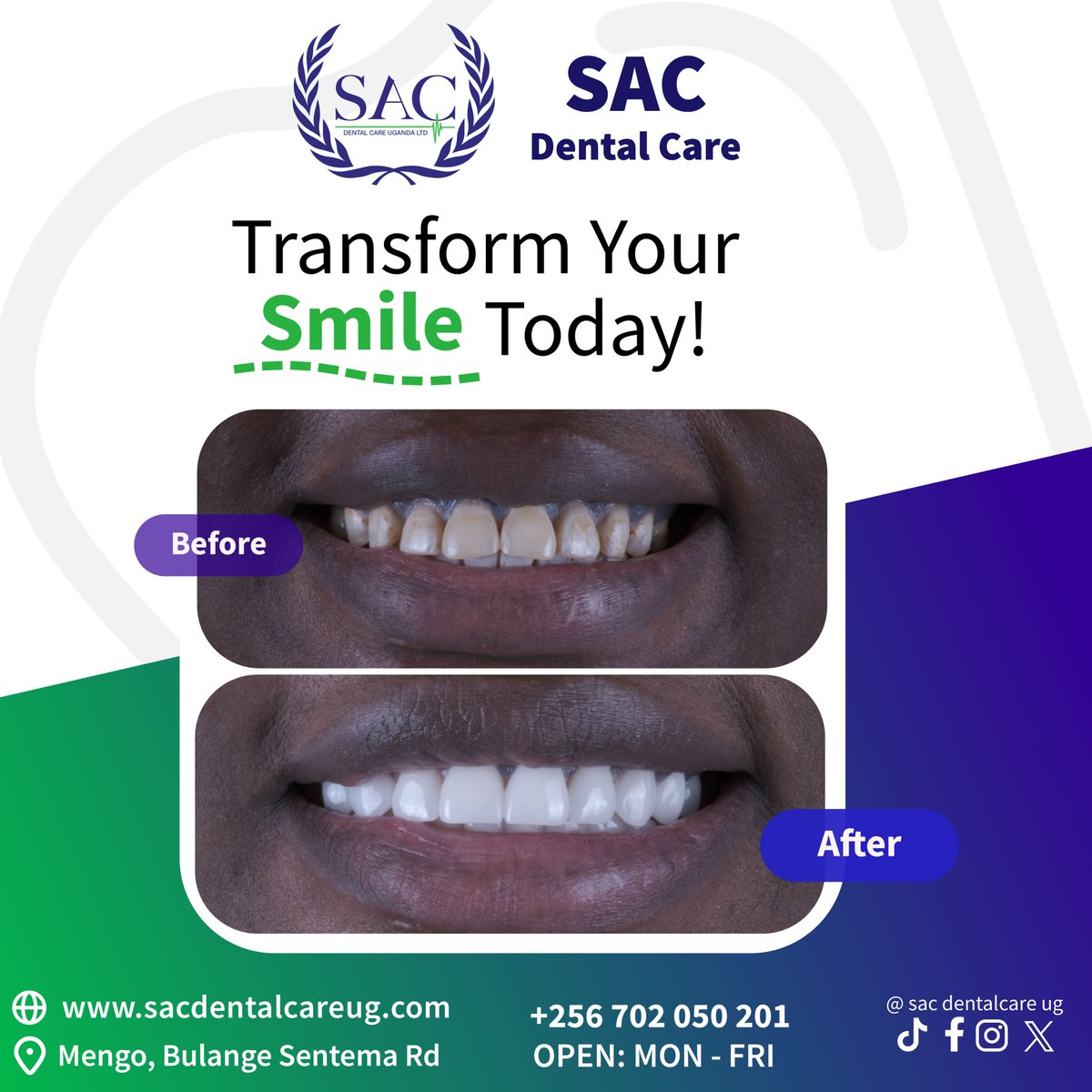 SAC_MDC's tweet photo. Your smile deserves the best care! 🦷✨ Discover the importance of regular dental check-ups and keep your teeth healthy! #DentalHealth #SmileBright https://t.co/YxxXPVronU