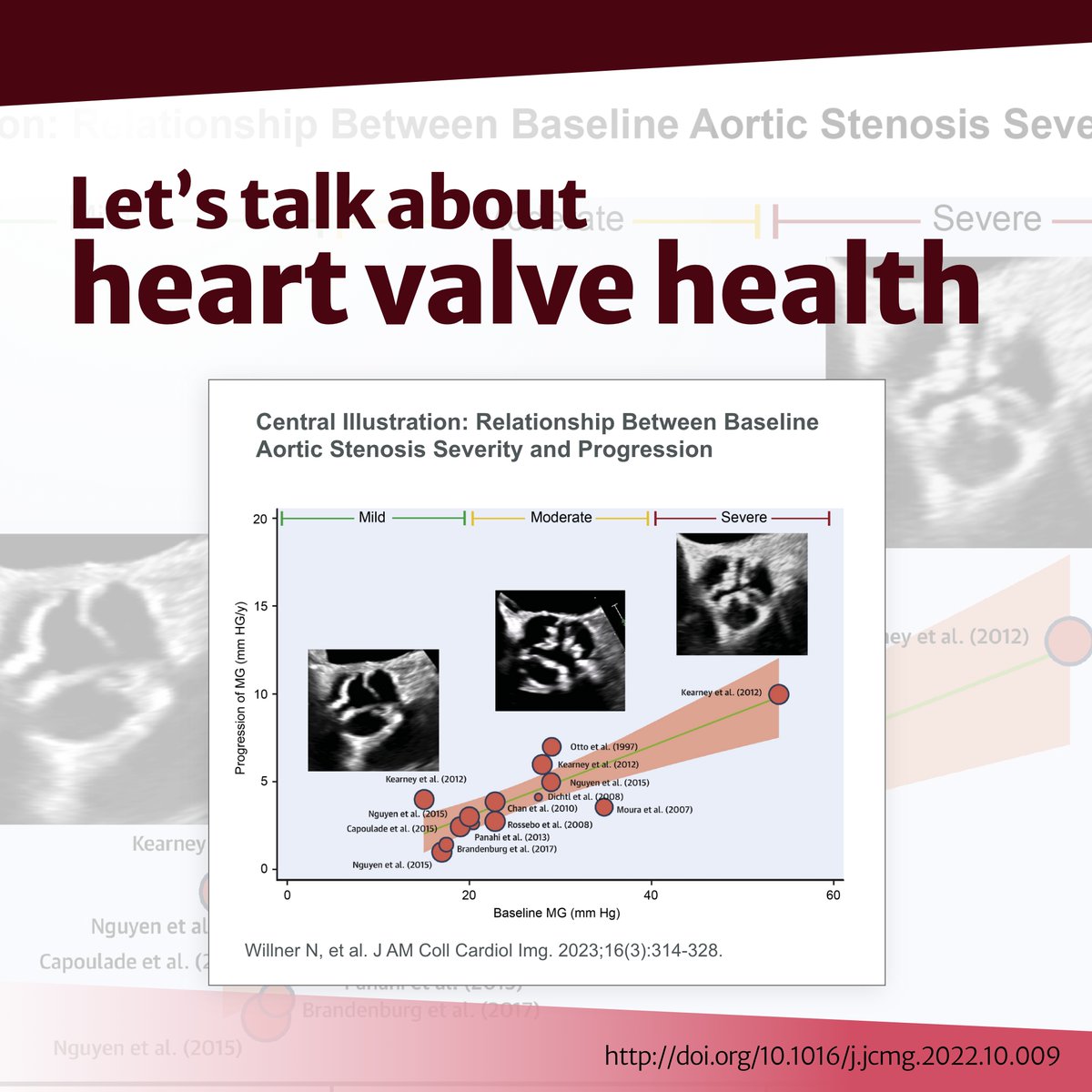 Sameer Gafoor (@sameergafoor) on Twitter photo Aortic stenosis threatens heart health, and increased severity means faster progression. I’m collaborating with <a href="/EdwardsLifesci/">Edwards Lifesciences</a> to emphasize how referring severe patients early keeps sudden progression from going unchecked. Learn more: bit.ly/3VNTAqk Aortic stenosis threatens heart health, and increased severity means faster progression. I’m collaborating with <a href="/EdwardsLifesci/">Edwards Lifesciences</a> to emphasize how referring severe patients early keeps sudden progression from going unchecked. Learn more: bit.ly/3VNTAqk
