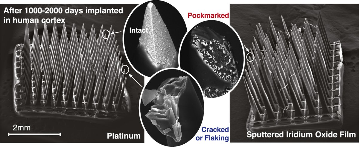 Acta Biomaterialia (@actabio) on Twitter photo Professor Richard Andersen: Quantifying physical degradation alongside recording & stimulation performance of 980 intracortical microelectrodes chronically implanted in three humans for 956-2246 days <a href="/davidbjanes/">David Bjånes</a> <a href="/CaltechBBE/">Caltech Division of BBE</a> <a href="/CaseEngineer/">CWRU Engineering</a> <a href="/UniofNewcastle/">Newcastle University</a> sciencedirect.com/science/articl… Professor Richard Andersen: Quantifying physical degradation alongside recording & stimulation performance of 980 intracortical microelectrodes chronically implanted in three humans for 956-2246 days <a href="/davidbjanes/">David Bjånes</a> <a href="/CaltechBBE/">Caltech Division of BBE</a> <a href="/CaseEngineer/">CWRU Engineering</a> <a href="/UniofNewcastle/">Newcastle University</a> sciencedirect.com/science/articl…