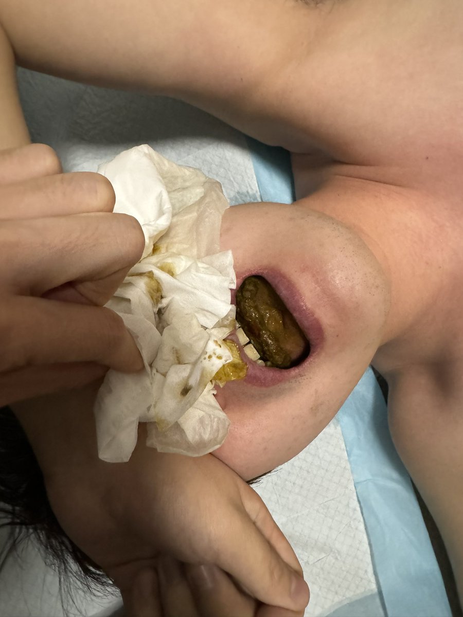 找了妈妈几次了
今天突破了黄金 必须记录一下啊。咨询qq1512315311