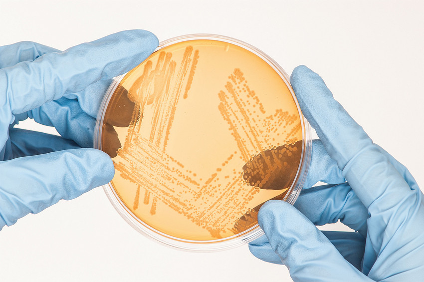 Ulster University spin-out company StimOxyGen raises £1.5 million to advance key preclinical studies, scale-up manufacturing, and expand its team as it moves towards clinical translation.

Read the full article: bit.ly/3XKILq6

#WeAreUU