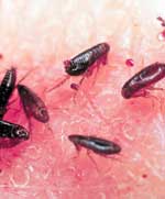 masters_pest's tweet image. Spring is coming, and so are fleas! Peak flea season is from March to November. Regular deep cleaning helps, but professional treatment can be necessary for complete eradication. Call Masters Pest Control for preventative flea treatments (877)-546-9575 #fleas #Masterspestcontrol