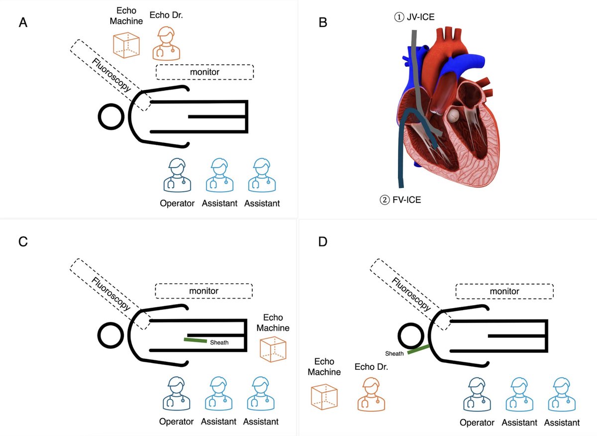 Hiroto Yagasaki, Cardiologist (@hirotoyagasaki) on Twitter photo Just Published in <a href="/JACCJournals/">JACC Journals</a>, @JACCCaseReports ! 🎉 We describe a novel internal jugular approach using ICE for PTSMA guidance. This technique offers a new option for echocardiographic assessment during PTSMA.
Link: authors.elsevier.com/sd/article/S26…
#ICE #PTSMA #HOCM Just Published in <a href="/JACCJournals/">JACC Journals</a>, @JACCCaseReports ! 🎉 We describe a novel internal jugular approach using ICE for PTSMA guidance. This technique offers a new option for echocardiographic assessment during PTSMA.
Link: authors.elsevier.com/sd/article/S26…
#ICE #PTSMA #HOCM
