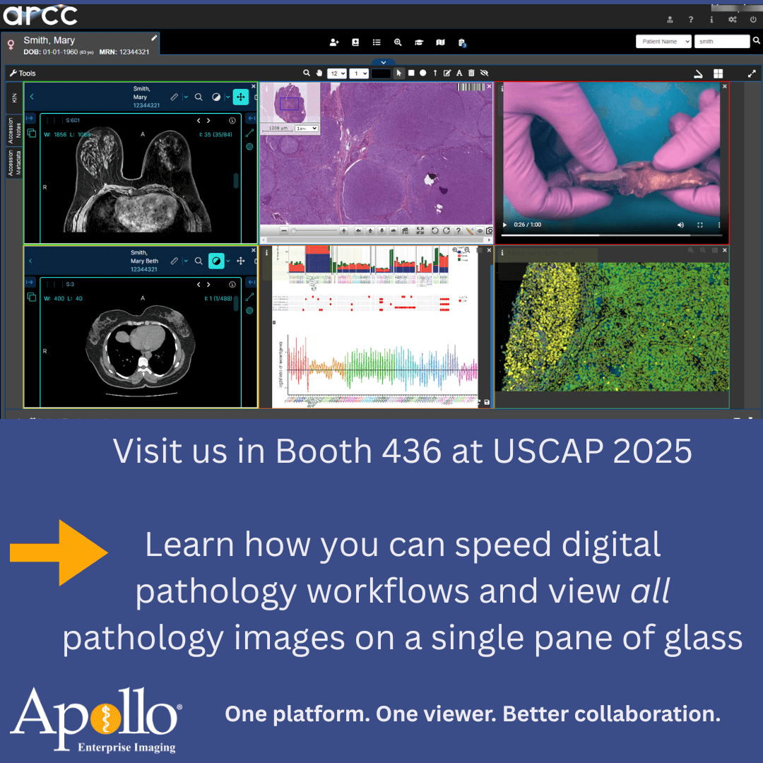 Apollo EI tweet media