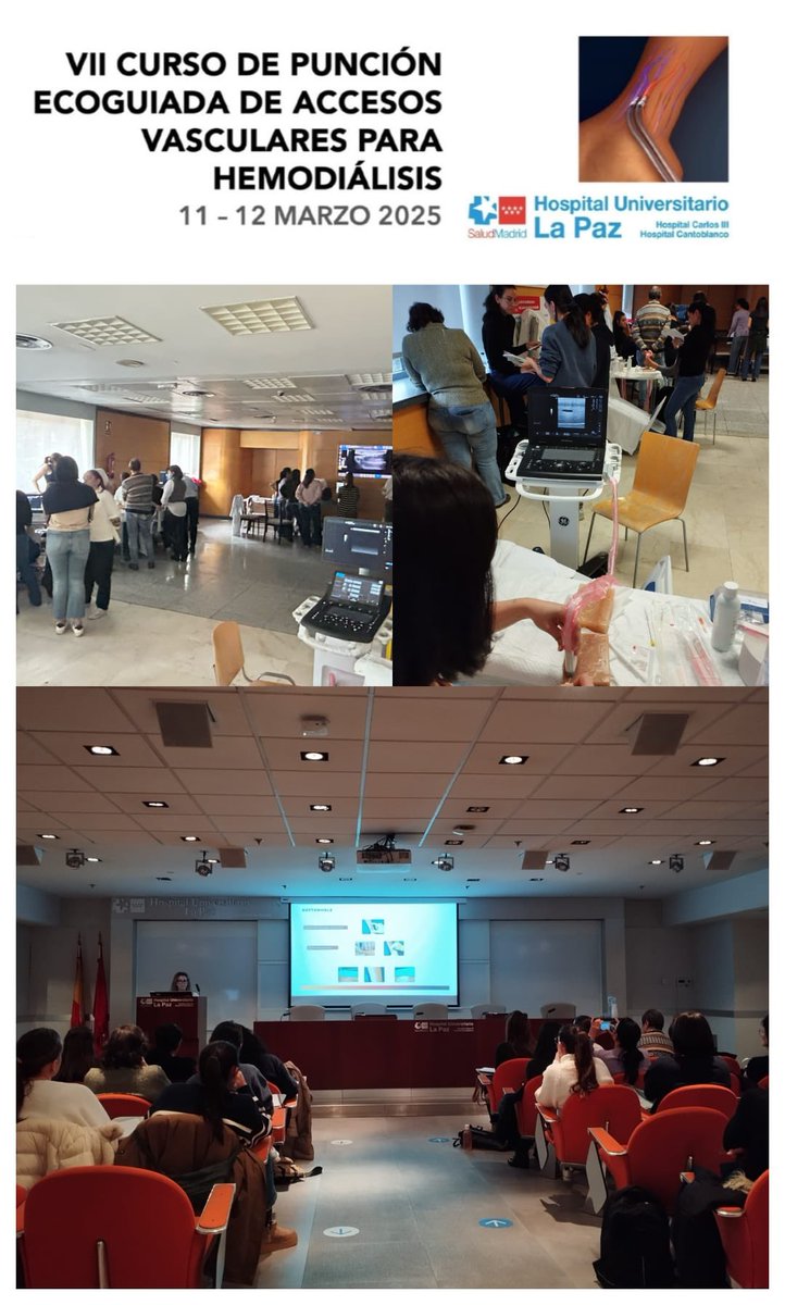 Nefrología H. La Paz Madrid (@nefrologialapaz) on Twitter photo En NefroLaPaz seguimos trabajando por el acceso vascular para hemodiálisis. ¡Finalizada con gran éxito la VII edición de nuestro curso!
Gracias a Nipro, GeneralElectric y <a href="/SOMANEorg/">Sociedad Madrileña de Nefrología (SOMANE)</a> por su ayuda!!!!! En NefroLaPaz seguimos trabajando por el acceso vascular para hemodiálisis. ¡Finalizada con gran éxito la VII edición de nuestro curso!
Gracias a Nipro, GeneralElectric y <a href="/SOMANEorg/">Sociedad Madrileña de Nefrología (SOMANE)</a> por su ayuda!!!!!