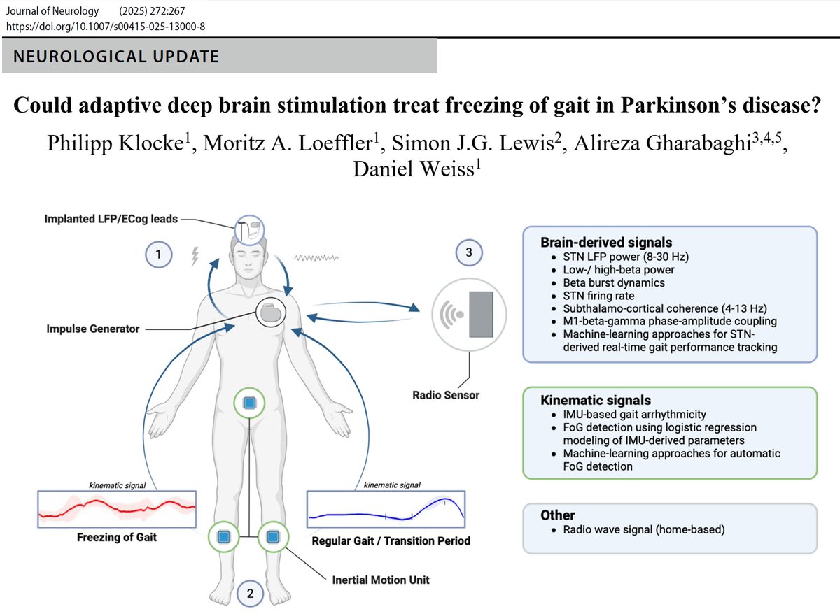 Hope that people enjoy this review about the potential for adaptive DBS to treat #Freezing of Gait (#FOG) in #Parkinson's Disease
link.springer.com/article/10.100…
