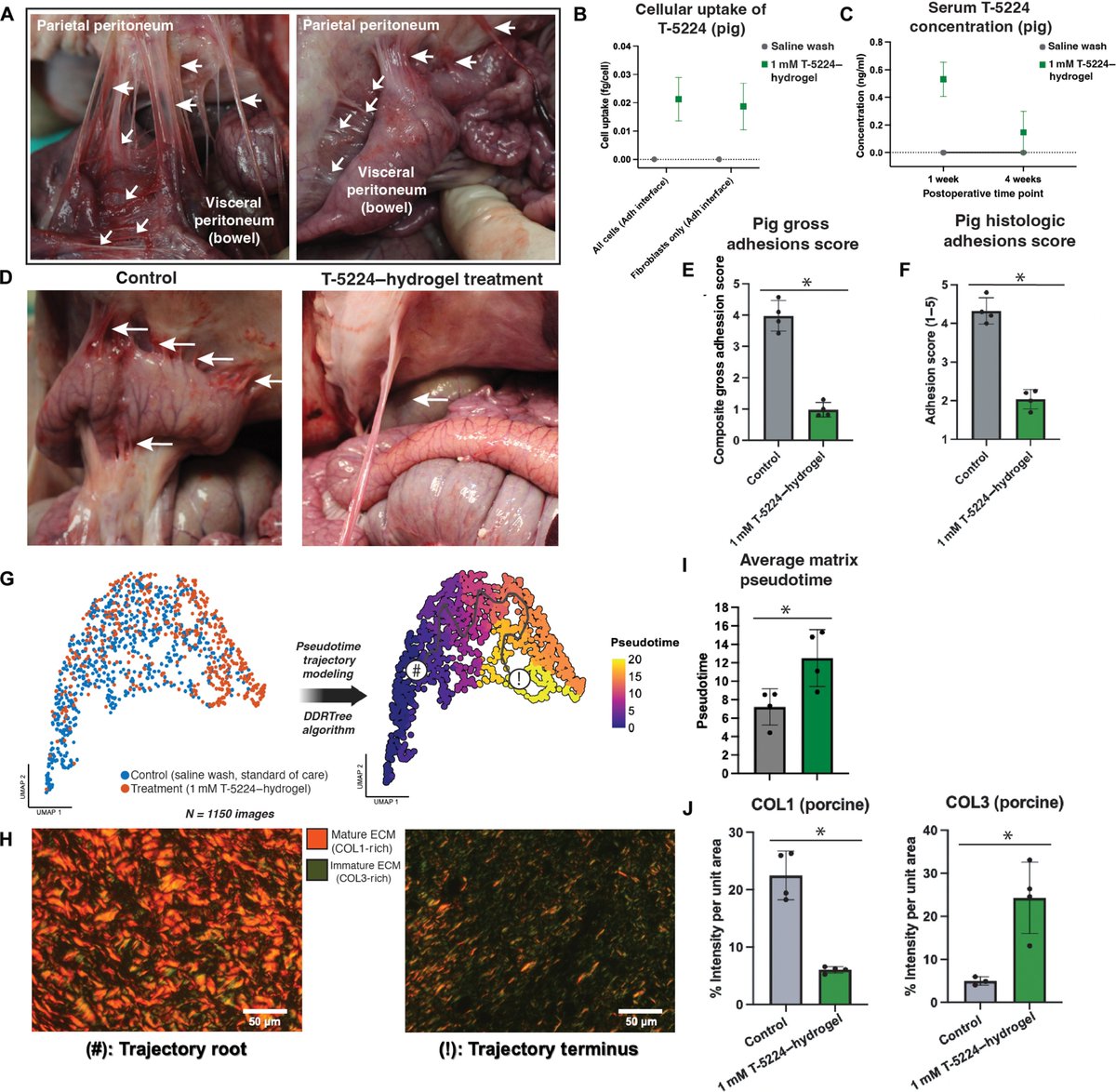 Waggoner Lab (@labwaggoner) on Twitter photo A hydrogel providing sustained release of a JUN inhibitor reduces postoperative abdominal adhesion in murine and porcine models
science.org/doi/10.1126/sc…
<a href="/ScienceTM/">Science Translational Medicine</a> <a href="/DrDrFoster/">Deshka Foster, MD, PhD</a> <a href="/LongakerLab/">Longaker Lab</a> <a href="/DelittoD/">Dan Delitto</a> A hydrogel providing sustained release of a JUN inhibitor reduces postoperative abdominal adhesion in murine and porcine models
science.org/doi/10.1126/sc…
<a href="/ScienceTM/">Science Translational Medicine</a> <a href="/DrDrFoster/">Deshka Foster, MD, PhD</a> <a href="/LongakerLab/">Longaker Lab</a> <a href="/DelittoD/">Dan Delitto</a>