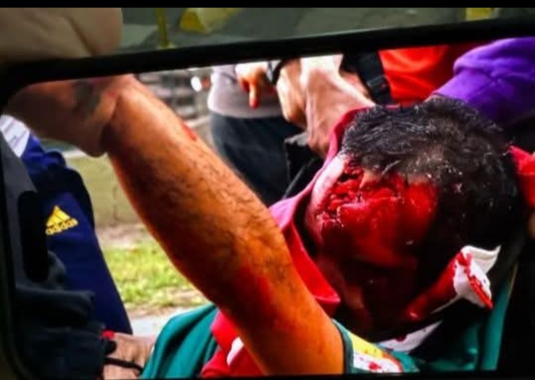 Quiero un Gobierno que cuide a su Pueblo, NO QUE LO ASESINE. <a href="/PatoBullrich/">Patricia Bullrich</a> tiene sangre en las manos, Debe renunciar.