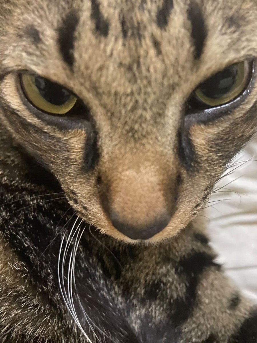 phobeloop's tweet image. โดนล้อว่าอ้วนเลยไปฉีดโบมา หน้าวีเชฟ