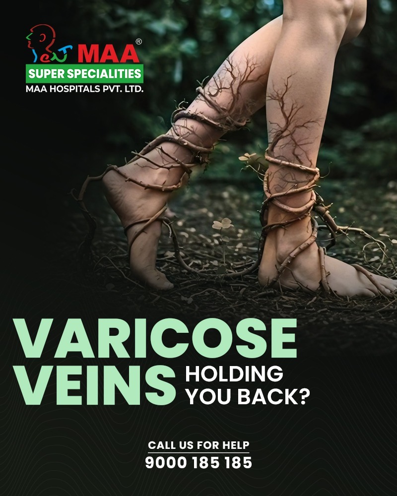 maaenthospitals's tweet image. Varicose veins? Prevent with exercise, healthy weight &amp;amp; avoiding prolonged sitting/standing. Treat with compression stockings, laser therapy or surgery. #VaricoseVeins #LegHealth #CirculationMatters #MAAHospitals #MaaSuperSpecialities