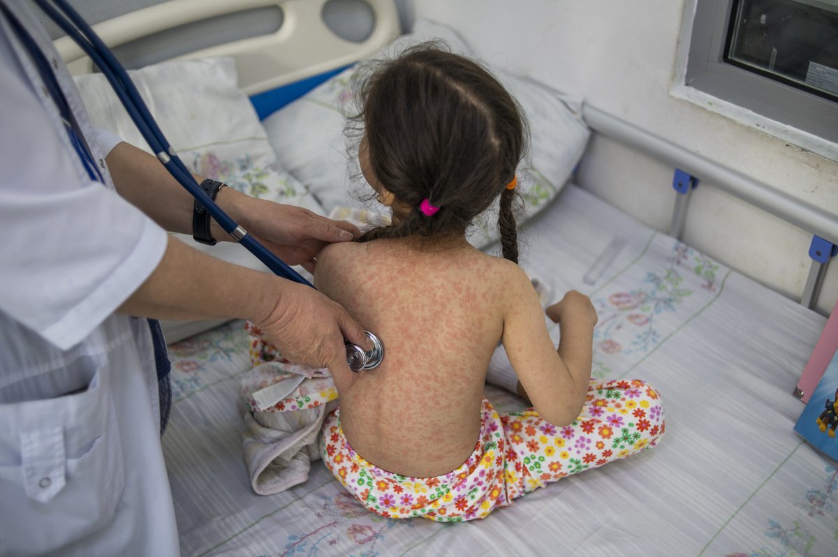 We're seeing our highest number of measles cases in 25 years.

127,350 measles cases were reported in the WHO European Region for 2024—nearly double the number reported in 2023.

Read the media release: bit.ly/3DFFK3w