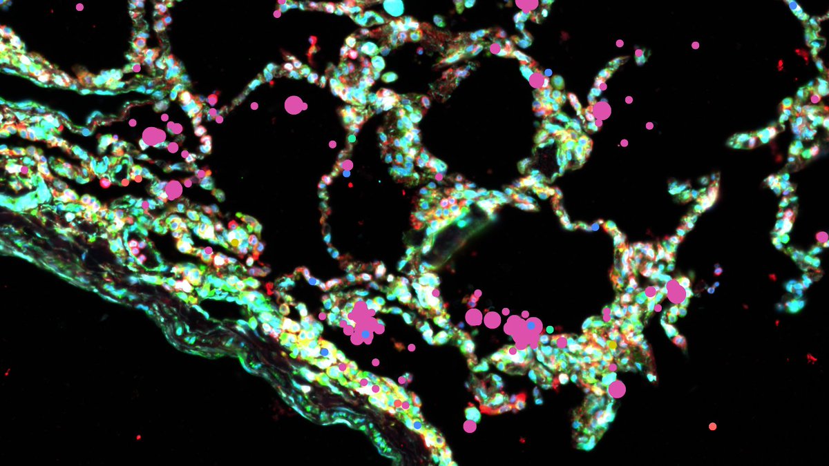 Kenny Roberts (@krobertssci) on Twitter photo Come and work for the brilliant <a href="/Josie_M_B/">Josie Bryant</a> and use cutting-edge single-cell and spatial data to explore host-microbe interactions in the lung 🔎🫁 Come and work for the brilliant <a href="/Josie_M_B/">Josie Bryant</a> and use cutting-edge single-cell and spatial data to explore host-microbe interactions in the lung 🔎🫁