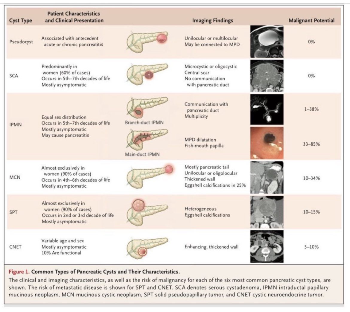 Cystic lesions of the pancreas 
Source: NEJM