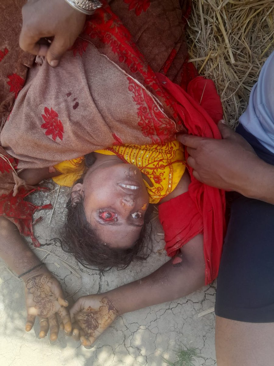 Kamal Singh Walia (@kamalwalia_) on Twitter photo दलित बेटी के साथ हैवानियत की हदें पार
शर्म करो नीतीश कुमार - NDA सरकार
महाजंगलराज के राजा <a href="/NitishKumar/">Nitish Kumar</a> के राज में बिहार फिर हुआ शर्मसार। नाबालिग दलित बेटी का आंख निकाल लिया, पेट फाड़ दिया, NDA सरकार में हैवान बन गए हैं गुंडे, दिन में बहन बेटियां सुरक्षित नहीं हैं और मुख्यमंत्री दलित बेटी के साथ हैवानियत की हदें पार
शर्म करो नीतीश कुमार - NDA सरकार
महाजंगलराज के राजा <a href="/NitishKumar/">Nitish Kumar</a> के राज में बिहार फिर हुआ शर्मसार। नाबालिग दलित बेटी का आंख निकाल लिया, पेट फाड़ दिया, NDA सरकार में हैवान बन गए हैं गुंडे, दिन में बहन बेटियां सुरक्षित नहीं हैं और मुख्यमंत्री