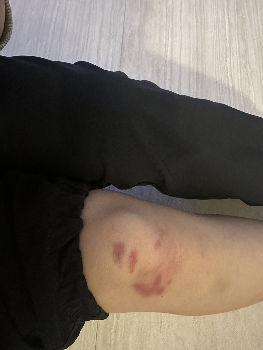 종철T ㅋㄹㅇㄷ 수업
내 무릎이 죽음…