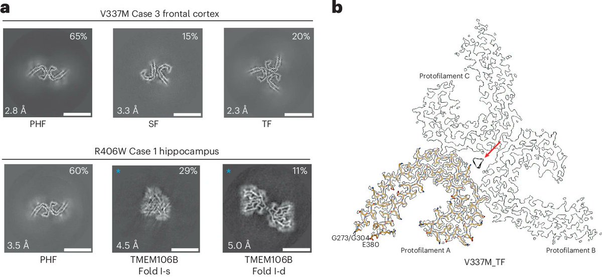 Chao Qi (@qichao8886) on Twitter photo Happy to share our latest publication on <a href="/NatureSMB/">NatureStructMolBiol</a> Natural Structure & Molecular Biology, we show tau filaments show Alzheimer fold in mutants V337M and R406W. nature.com/articles/s4159…
nature.com/articles/s4159…
thanks <a href="/SjorsScheres/">Sjors Scheres</a> and <a href="/MichelGoed/">Michel Goedert</a> support 🥳🥳🥳 Happy to share our latest publication on <a href="/NatureSMB/">NatureStructMolBiol</a> Natural Structure & Molecular Biology, we show tau filaments show Alzheimer fold in mutants V337M and R406W. nature.com/articles/s4159…
nature.com/articles/s4159…
thanks <a href="/SjorsScheres/">Sjors Scheres</a> and <a href="/MichelGoed/">Michel Goedert</a> support 🥳🥳🥳