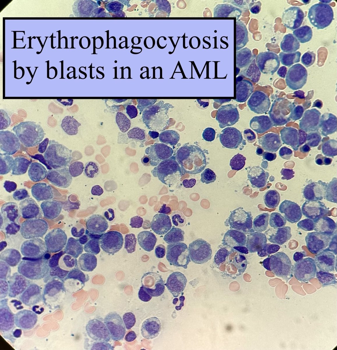 Kathryn Lindsey (@pathologykate) on Twitter photo 