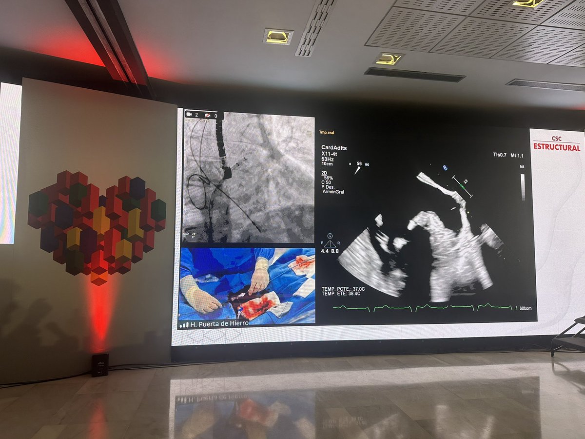 Mónica Fernández Quero (@monicaferqu) on Twitter photo A top-level left atrial appendage closure session: great learnings, valuable tips, and the best in innovation. An honor to listen from experts! 🔝👏🏼#CSCestructural #MedicalInnovation <a href="/shci_sec/">ACI-SEC: Hemodinamica</a> <a href="/secardiologia/">Soc Esp Cardiología</a> <a href="/icruzgonzalez/">Ignacio Cruz Gonzalez</a> <a href="/StructuralBCN/">Dabit Arzamendi</a> <a href="/cardioyoguini/">Neus Salvatella</a> <a href="/belcid7/">Belén Cid Alvarez</a> <a href="/MPAOSS/">Manuel Pan</a> A top-level left atrial appendage closure session: great learnings, valuable tips, and the best in innovation. An honor to listen from experts! 🔝👏🏼#CSCestructural #MedicalInnovation <a href="/shci_sec/">ACI-SEC: Hemodinamica</a> <a href="/secardiologia/">Soc Esp Cardiología</a> <a href="/icruzgonzalez/">Ignacio Cruz Gonzalez</a> <a href="/StructuralBCN/">Dabit Arzamendi</a> <a href="/cardioyoguini/">Neus Salvatella</a> <a href="/belcid7/">Belén Cid Alvarez</a> <a href="/MPAOSS/">Manuel Pan</a>