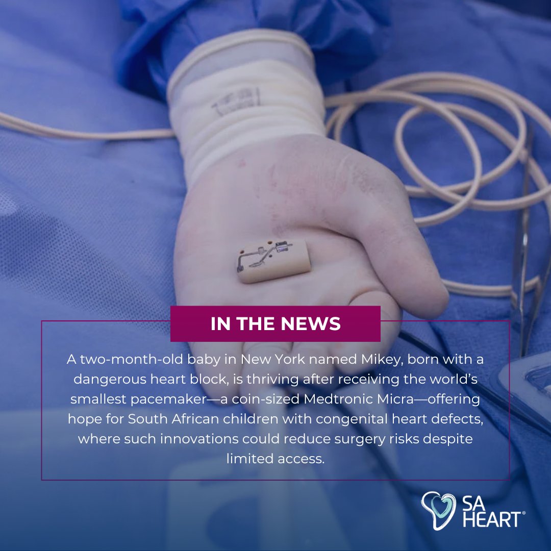 NY baby Mikey thrives with world’s smallest pacemaker (Medtronic Micra) for heart block, offering hope for SA kids with defects despite limited access.