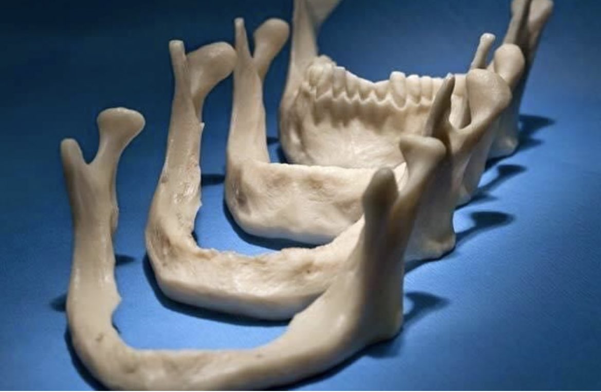 cuando te pregunten porque es necesario conservar los dientes hasta el último muéstrales esta imagen