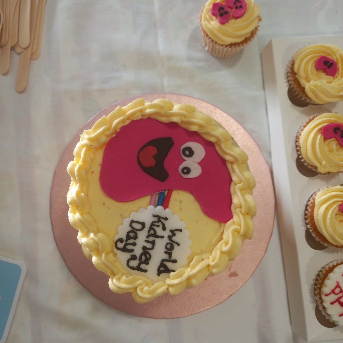 Ji Soo Kim (@kimneyj) on Twitter photo Happy #WorldKidneyDay !
Check out this amazing cake at <a href="/EvelinaLondon/">Evelina London</a>
I can't take credit for baking it but I take absolute credit for eating it.
<a href="/worldkidneyday/">World Kidney Day</a> <a href="/BAPNnephrology/">BAPN</a> Happy #WorldKidneyDay !
Check out this amazing cake at <a href="/EvelinaLondon/">Evelina London</a>
I can't take credit for baking it but I take absolute credit for eating it.
<a href="/worldkidneyday/">World Kidney Day</a> <a href="/BAPNnephrology/">BAPN</a>