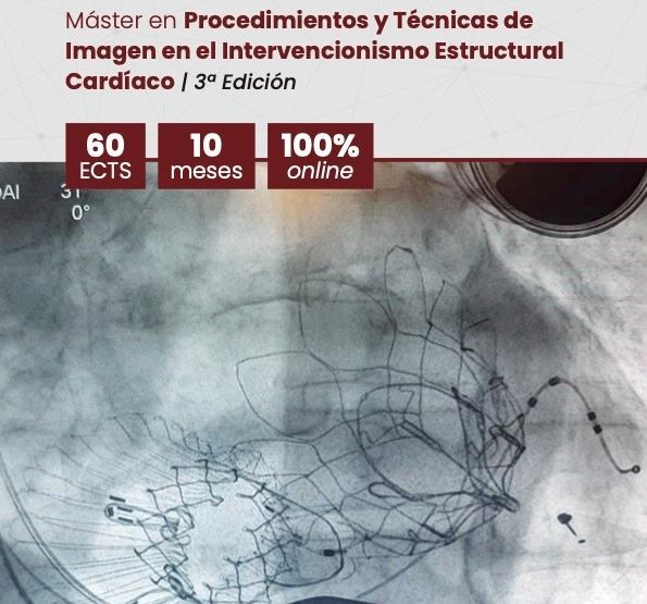 ¡EN MARCHA!
3ª Ed. del renovado Máster en Procedimientos y Técnicas de Imagen en el Intervencionismo Estructural Cardíaco
Info ℹ️ buff.ly/iTg0KIw ◀️
Registro 📝 buff.ly/7BGtaBC ◀️
PDF 📂 buff.ly/OFTbe2S ◀️
No lo dejes pasar