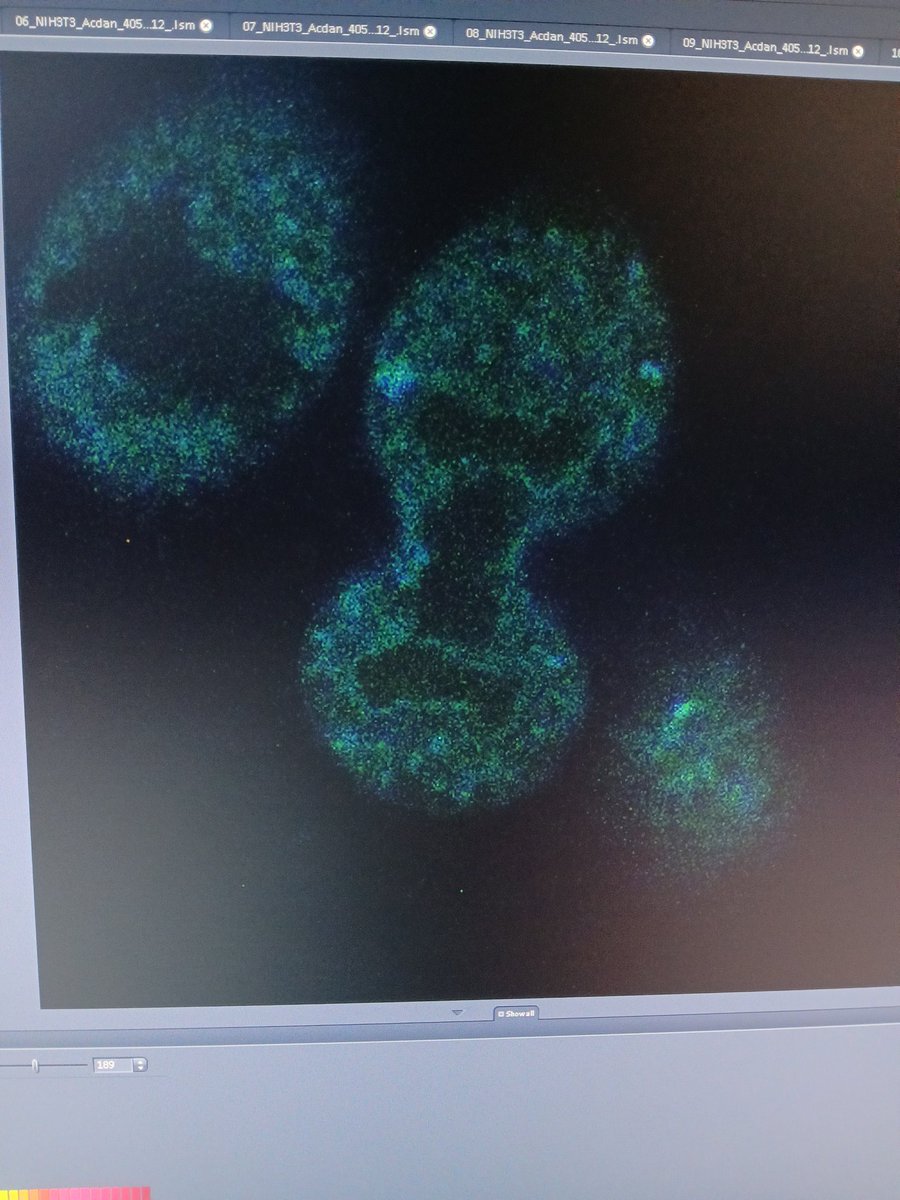 MuktarLawan15's tweet photo. I’m excited to have learned how to acquire spectral images that can transform healthcare. I look forward to exploring phasor analysis. Thanks to @MalacridaLab, @Marceladiazf and the IPM community for their support and to my mentor @mahmoudbukar for this career shaping opportunity https://t.co/QHHjhmc2sN