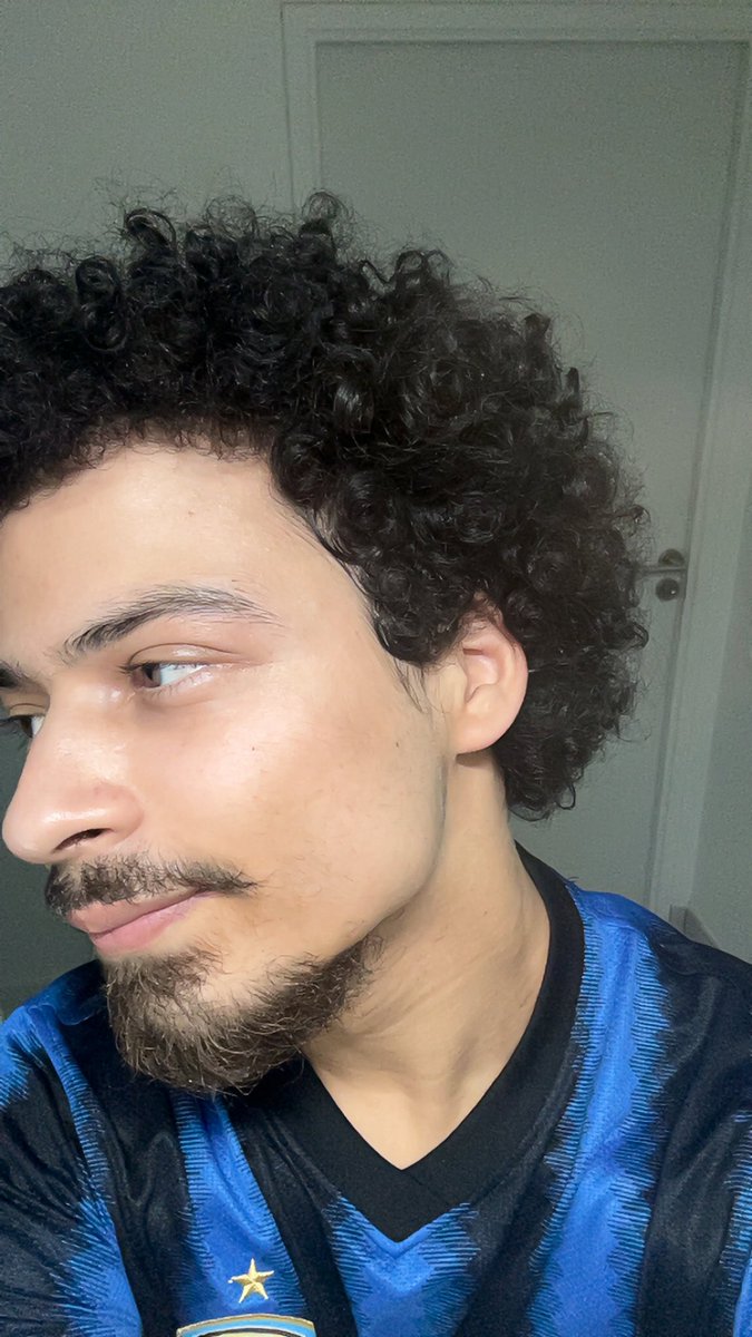 Ce que aromazone viens de faire à ma peau les mecs ptdrrrr azy juste wow la vie