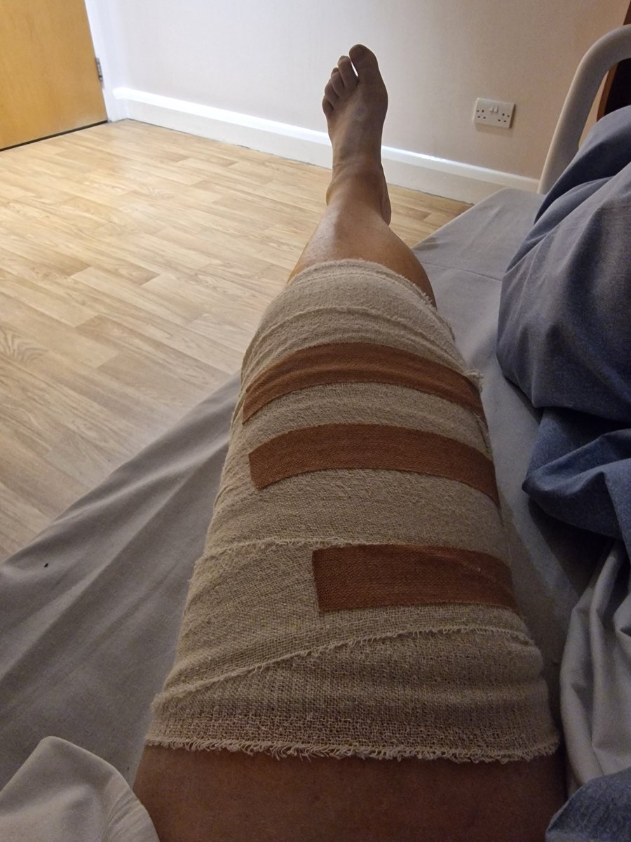 Little bit of knee surgery