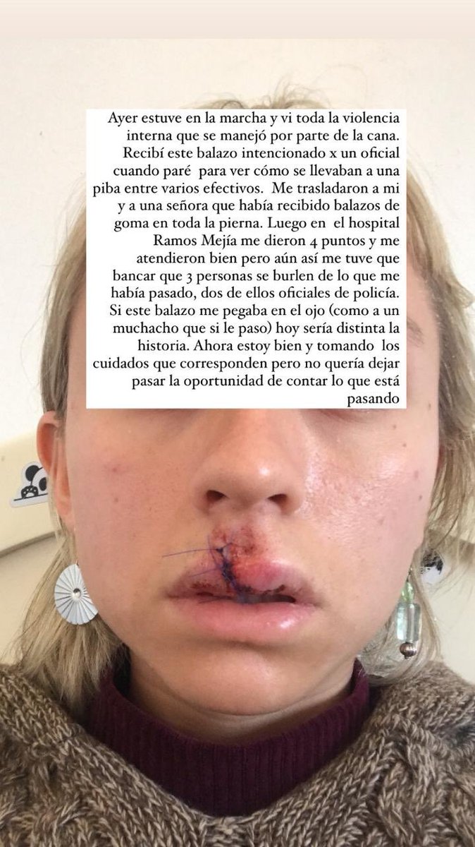 Sandra Igelka tweet media