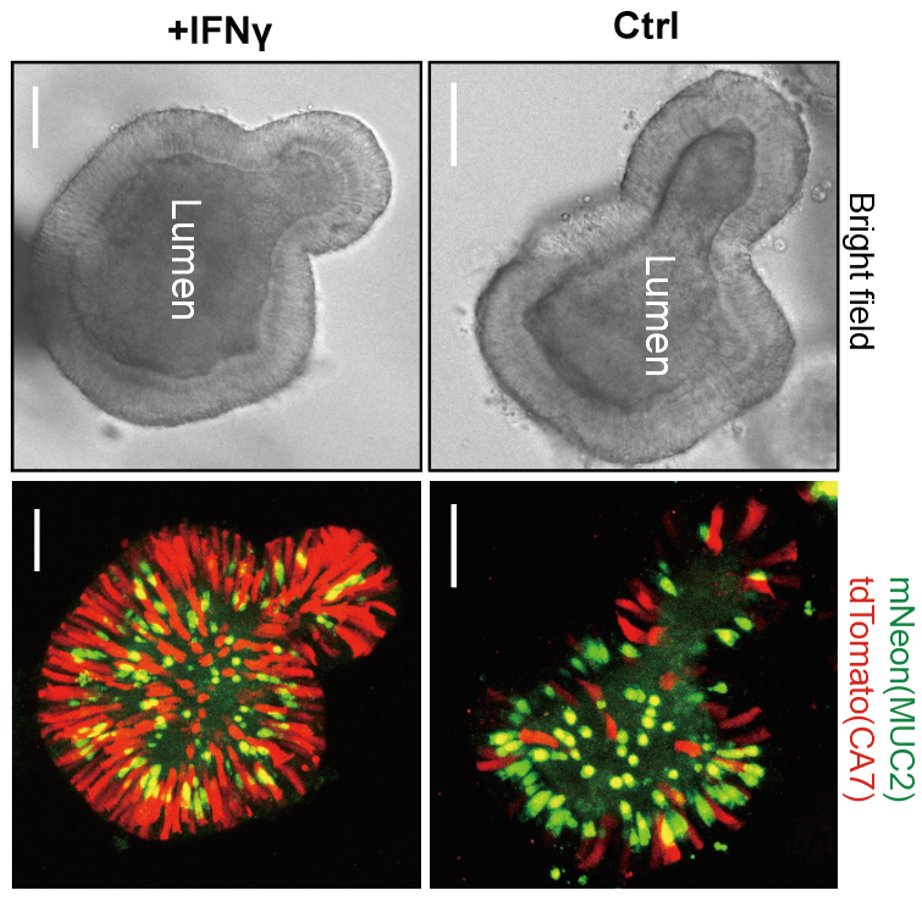 Daisong Wang et al report that BEST4/CA7+ gut cells regulate electrolyte and water balance in response to diarrheal bacterial toxins These cells greatly increase in number when exposed to IFNγ cell.com/cell-stem-cell…