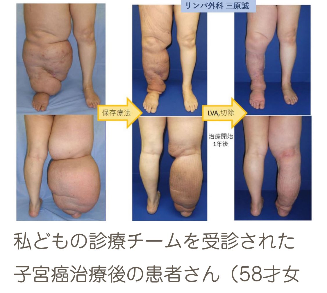 そこら辺の人 (@CPNKMIMBqGKbfv0)  X