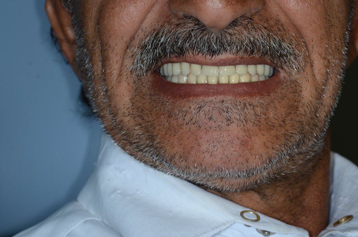 smile restored
happiness delivered 🪄

<a href="/Dr__Lolia/">لمى🐾</a> 👭