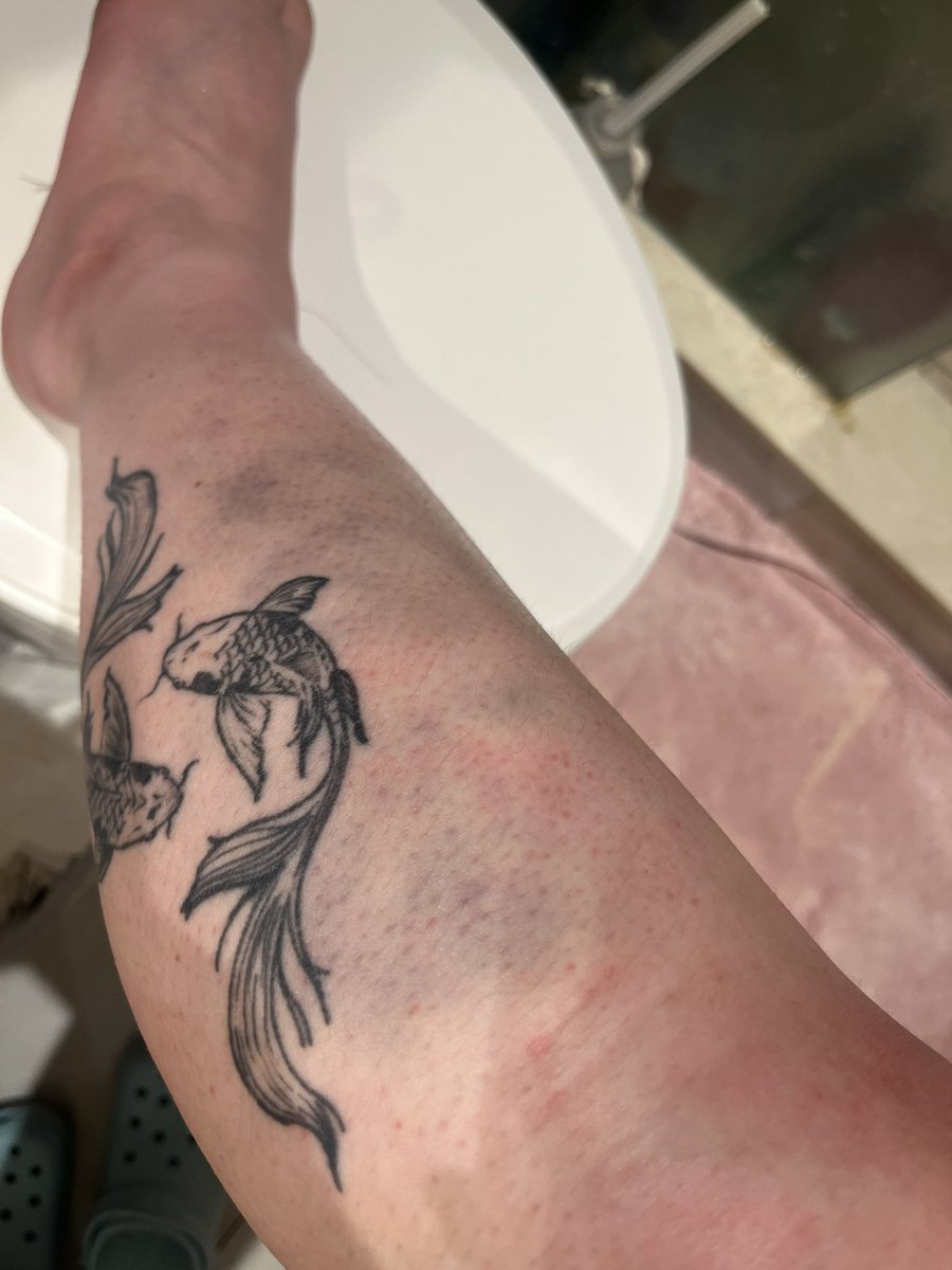 shellzoh's tweet image. i lost to a fence