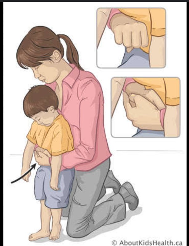 Dear Parents,

Y'all needs to know about this basic gesture that will save your  child's life in case of suffocation!

Check Thread 👇