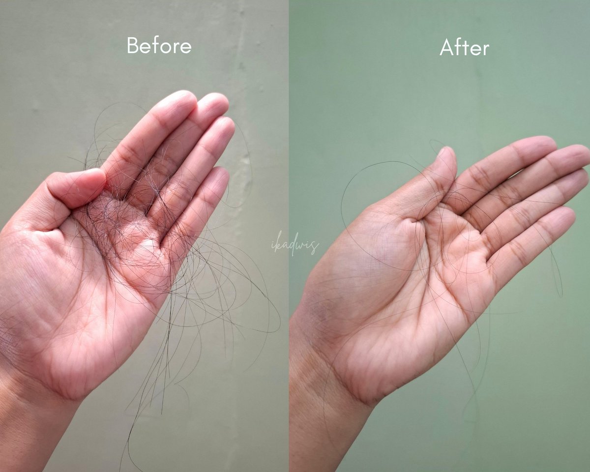 ikadwis's tweet photo. Akhirnyaaa penasaranku terjawab sudah sama Leobos ini 😭
Makin stres gak sih kalo rambut rontok terus??? 
Aku punya solusi nih buat kalian buat ngatasin rambut rontok 🤗

#reviewLeobos #Leobos #Shampoo #reviewbyids #HairCareForUnisex https://t.co/v6dUjz3cx6