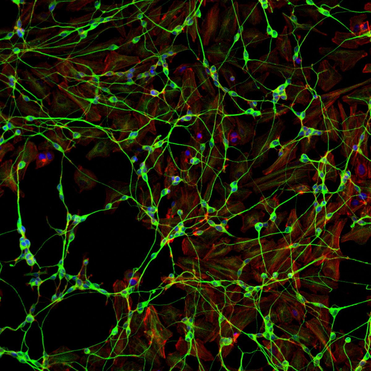ibidi GmbH (@ibidicells) on Twitter photo #March Moments: Image of the Month 📆
🧠The beautiful intricacies of an electrified neuronal network captured on a <a href="/zeiss_micro/">ZEISS Microscopy</a> Confocal microscope🔬
🥼Image by <a href="/barbaramsousa20/">Bárbara Sousa</a> & Sandra Vieira from <a href="/ibimed_ua/">Institute of Biomedicine - iBiMED</a>, <a href="/UnivAveiro/">Universidade Aveiro</a> 🇵🇹
<a href="/PPBioImaging/">PPBI-Portuguese Platform of BioImaging</a>
#neurons #microscopy #sciart #bioart #March Moments: Image of the Month 📆
🧠The beautiful intricacies of an electrified neuronal network captured on a <a href="/zeiss_micro/">ZEISS Microscopy</a> Confocal microscope🔬
🥼Image by <a href="/barbaramsousa20/">Bárbara Sousa</a> & Sandra Vieira from <a href="/ibimed_ua/">Institute of Biomedicine - iBiMED</a>, <a href="/UnivAveiro/">Universidade Aveiro</a> 🇵🇹
<a href="/PPBioImaging/">PPBI-Portuguese Platform of BioImaging</a>
#neurons #microscopy #sciart #bioart
