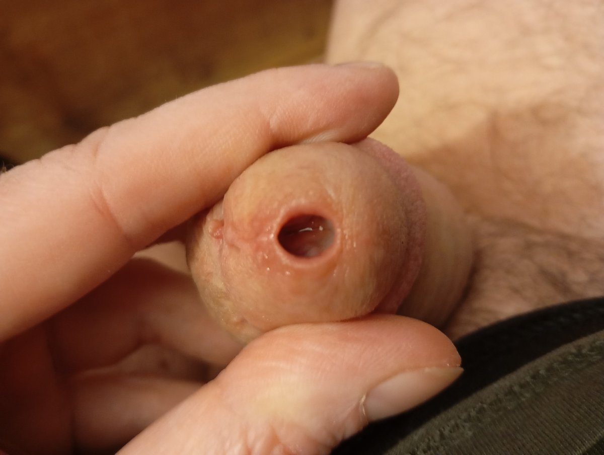 good session today, got up to 10mm and let it resto for almost an hour after some fun with other sounds.
#cocksounding #urethraplay #cutcock #urethralsounding #cockstuffing #peeholeplay #urethrasounding #hegarsound