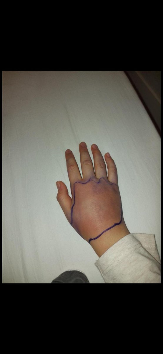 sepa tamer tweet media