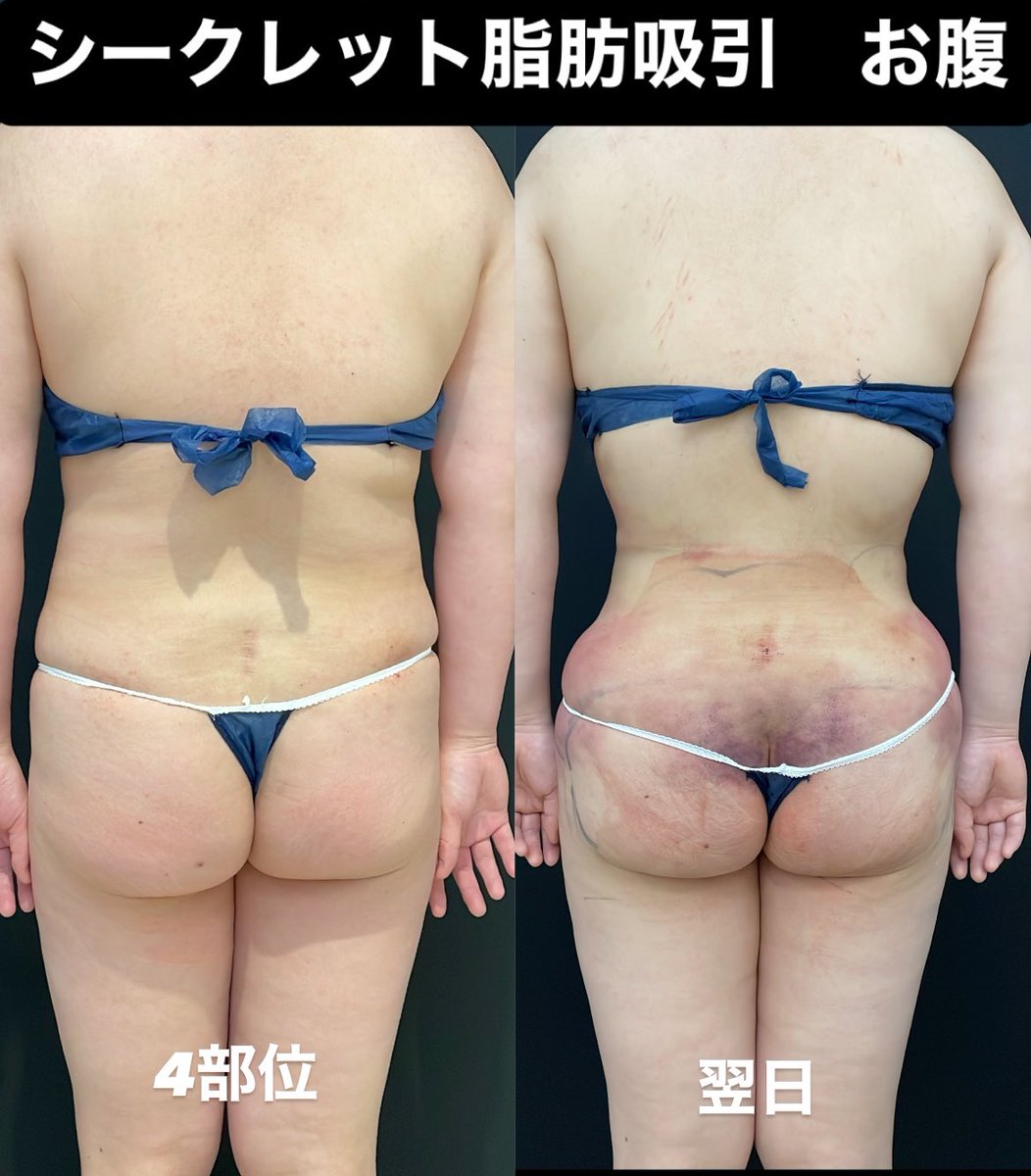 碧あお様❁専用ページ 碧 あお💚🍣 (@sushikuwasero_0) / Posts / X