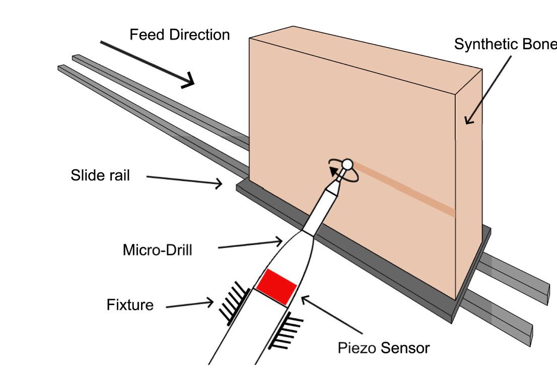 Vikram Pakrashi (@dsrl_ucdmech) on Twitter photo 👏👏Nola Dubuisson. New paper on experimental modal analysis of hand-held burs for #biomedical applications, led by <a href="/RounakAasifa/">Aasifa Rounak</a> working with Stryker.
Link: lnkd.in/dHhwiyj6
<a href="/I_Form_Centre/">I-Form</a> <a href="/UCDmechanics/">UCDmechanics</a> <a href="/Researchirel/">Research Ireland</a> <a href="/UCDBiomedEng/">UCD Biomedical Eng</a> <a href="/NUIMerrionSq/">NUI</a> <a href="/UCD_Mech_Eng/">UCD School of Mechanical and Materials Engineering</a> 👏👏Nola Dubuisson. New paper on experimental modal analysis of hand-held burs for #biomedical applications, led by <a href="/RounakAasifa/">Aasifa Rounak</a> working with Stryker.
Link: lnkd.in/dHhwiyj6
<a href="/I_Form_Centre/">I-Form</a> <a href="/UCDmechanics/">UCDmechanics</a> <a href="/Researchirel/">Research Ireland</a> <a href="/UCDBiomedEng/">UCD Biomedical Eng</a> <a href="/NUIMerrionSq/">NUI</a> <a href="/UCD_Mech_Eng/">UCD School of Mechanical and Materials Engineering</a>