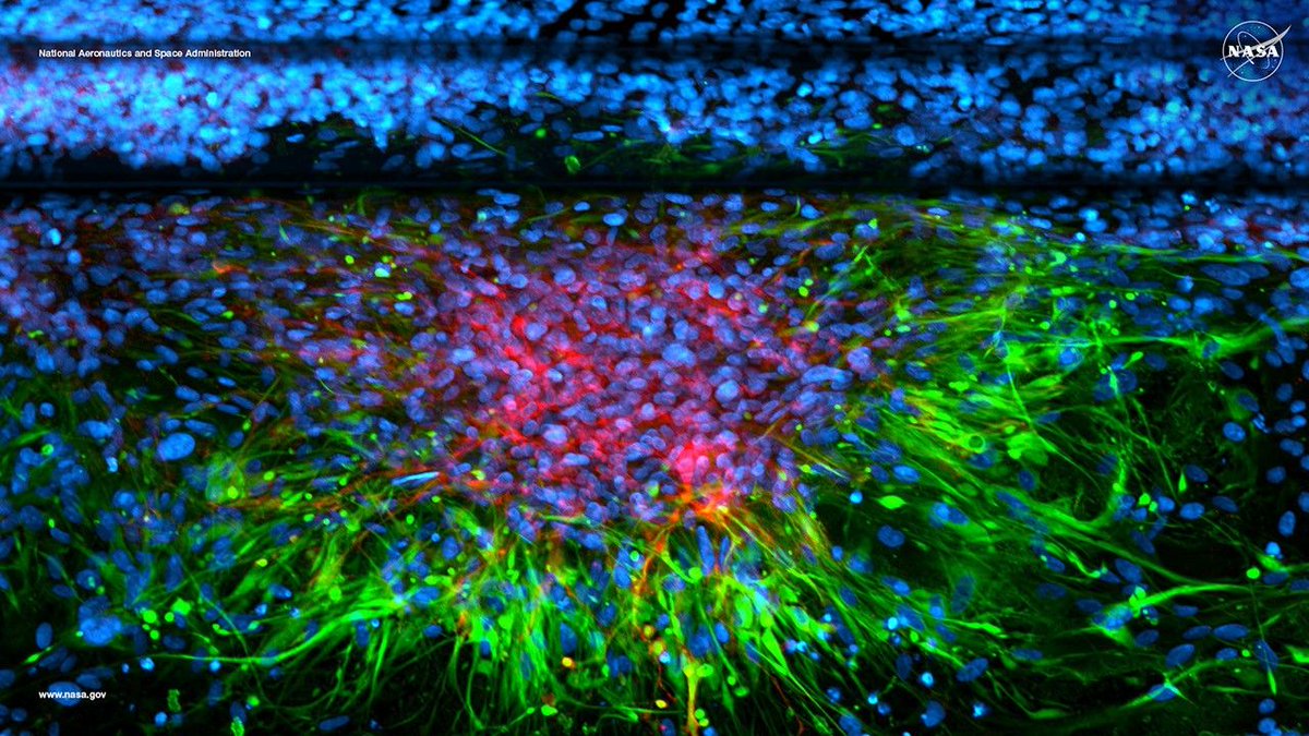 NASAScienceAA's tweet image. Time to turn the page! 📆

March’s #NASAScience image showcases a simulated brain model, revealing how space radiation affects astrocytes—cells that help regulate brain health. Understanding these effects is crucial for future lunar missions. Explore more: go.nasa.gov/4i1It6e