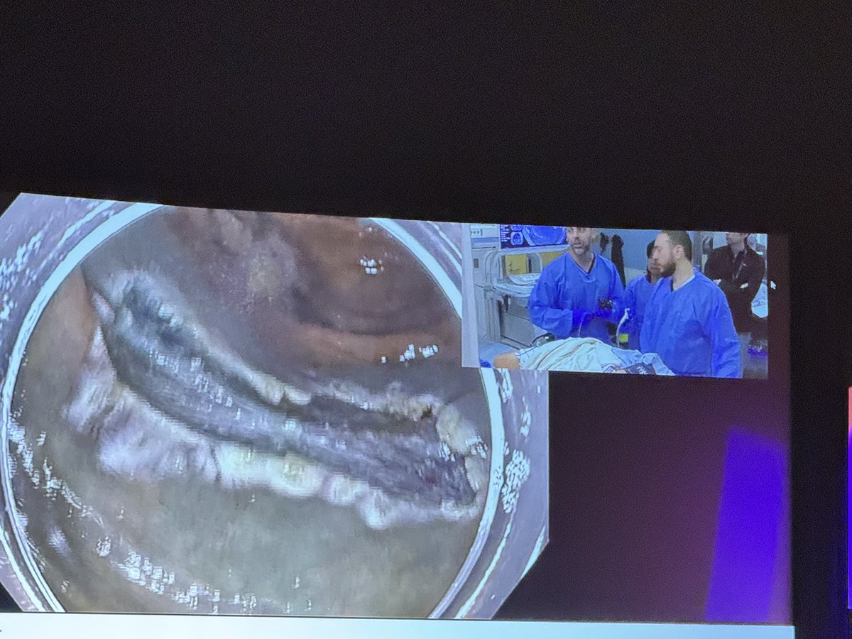 McGill Division of Gastroenterology and Hepatology (@mcgillgi) on Twitter photo Congratulations to Dr Yen-I Chen and all of the faculty and nurses for organizing an excellent live endoscopy course <a href="/cddw_clm/">Joint CDDW™-CLM Conference | #CDDWCLM2025</a> <a href="/cusm_muhc/">Centre universitaire de santé McGill</a> <a href="/TBessissow/">Talat Bessissow</a> Amazing work! Congratulations to Dr Yen-I Chen and all of the faculty and nurses for organizing an excellent live endoscopy course <a href="/cddw_clm/">Joint CDDW™-CLM Conference | #CDDWCLM2025</a> <a href="/cusm_muhc/">Centre universitaire de santé McGill</a> <a href="/TBessissow/">Talat Bessissow</a> Amazing work!