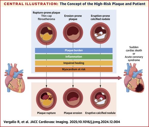 Edgardo Alania (@ed_alania) on Twitter photo 🔴 Vulnerable or High-Risk Plaque: A JACC: Cardiovascular ImagingPosition Statement <a href="/JACCJournals/">JACC Journals</a> #CardioEd #Cardiology #CardioX 🔴 Vulnerable or High-Risk Plaque: A JACC: Cardiovascular ImagingPosition Statement <a href="/JACCJournals/">JACC Journals</a> #CardioEd #Cardiology #CardioX